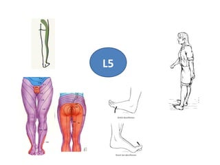 Disc Prolapse Classification Lumbar disc prolapse | PPT