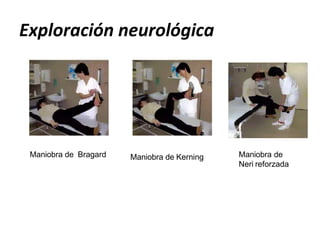 Exploración neurológica
Maniobra de Kerning
Maniobra de Bragard Maniobra de
Neri reforzada
 