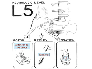 Extensor de
los dedos
L5
Ninguno
 