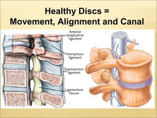 Lumbar Spine and Sciatica | PPT