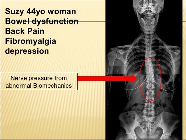 Lumbar Spine and Sciatica