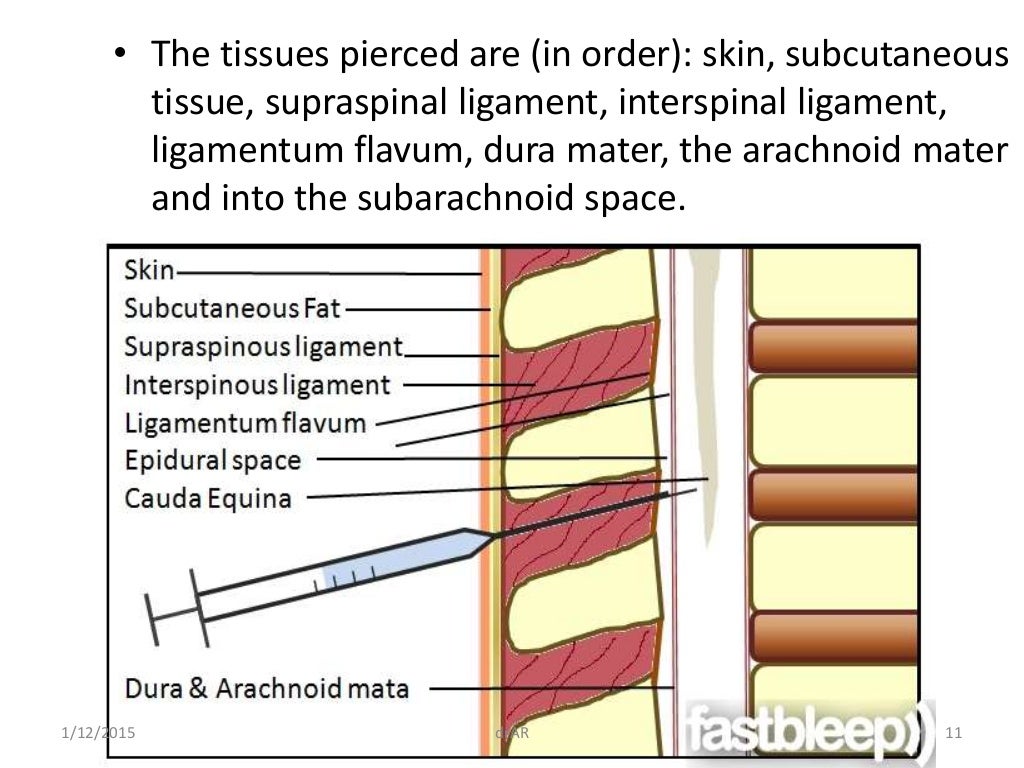 Lumbar Puncture Anatomy