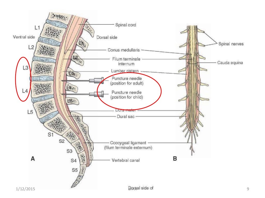 Lumbar puncture