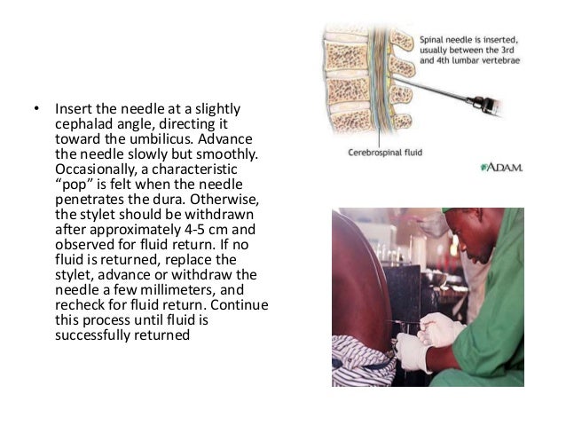 for solution headache puncture Lumbar for solution headache puncture Lumbar