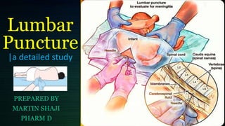 Lumbar
Puncture
|a detailed study
PREPARED BY
MARTIN SHAJI
PHARM D
 