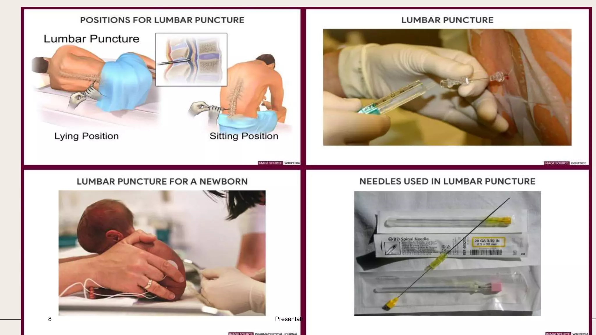 Lumbar Puncture pptx lumbar-puncture-pptx