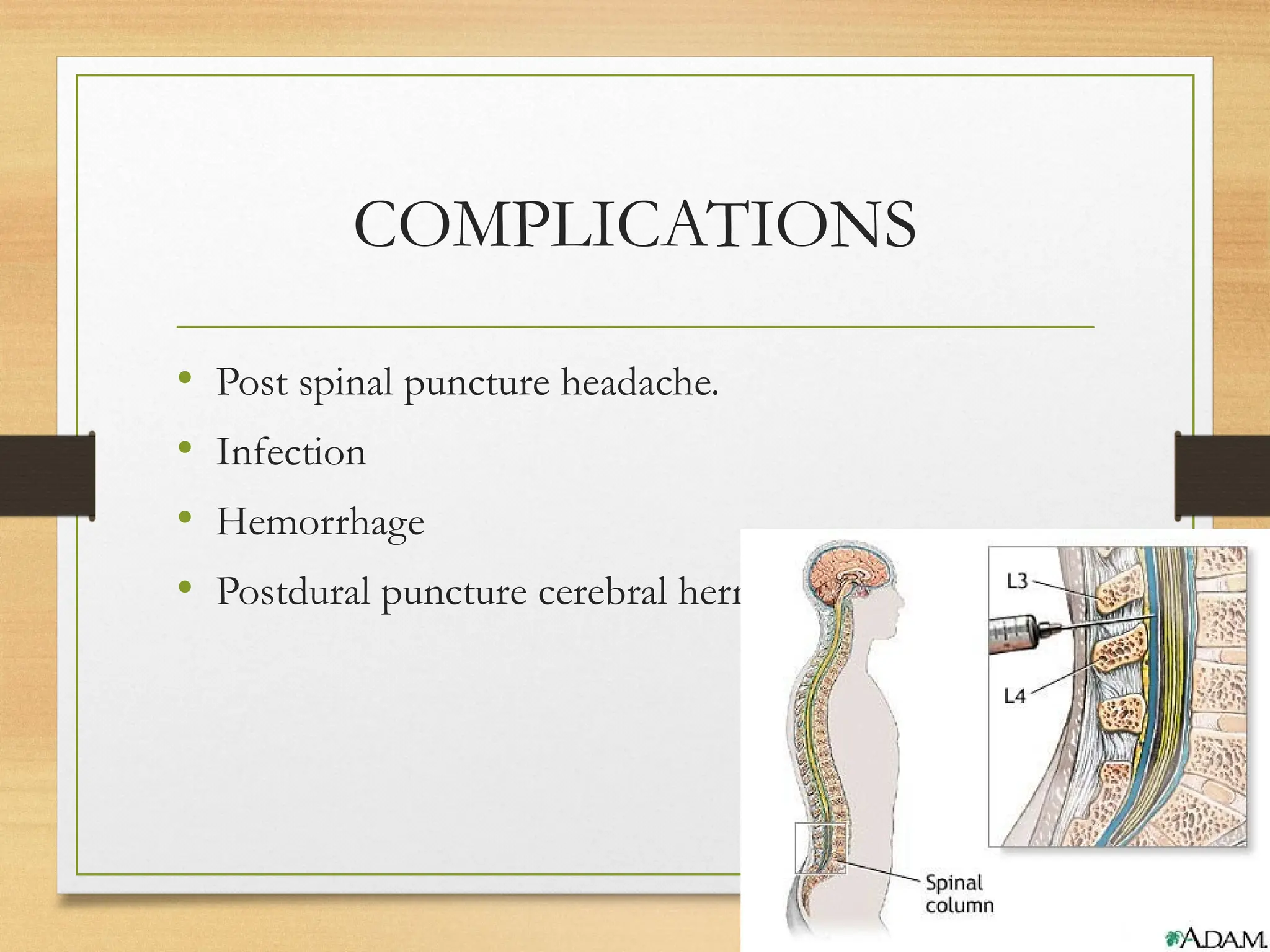 COMPLICATIONS
• Post spinal puncture headache.
• Infection
• Hemorrhage
• Postdural puncture cerebral herniation
 