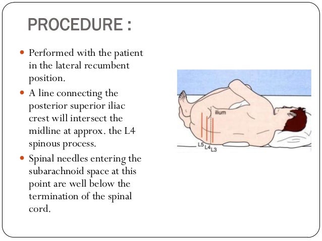Lumbar Puncture And Bone Marrow Aspiration
