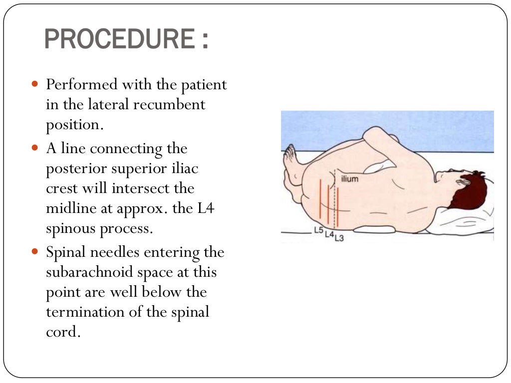 Lumbar puncture and bone marrow aspiration