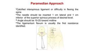 Paramedian Approach
•Calcified interspinous ligament or difficulty in flexing the
spine
•The needle should be inserted 1 cm lateral and 1 cm
inferior of the superior spinous process of desired level.
 Angle should be 10-25 toward midline
•The ligamentum flavum is usually the first resistance
identified.
 