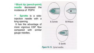 Blunt tip (pencil-point)
needle decreased the
incidence of PDPH
 Sprotte is a side-
injection needle with a
long opening.
It has the advantage of
more vigorous CSF flow
compared with similar
gauge needles.
 