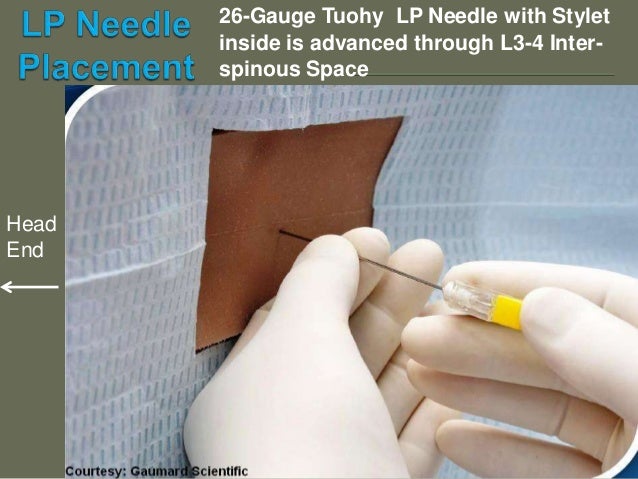 puncture on turbo trainer