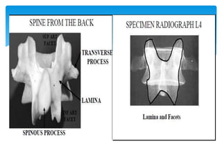 Practical Radiology Of Lumbar spine | PPTX