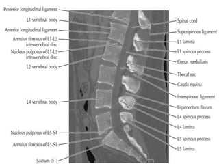 Practical Radiology Of Lumbar spine | PPTX