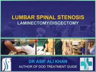 LUMBAR SPINAL STENOSIS
LAMINECTOMY/DISCECTOMY
DR ASIF ALI KHAN
AUTHOR OF DOD TREATMENT GUIDE
 