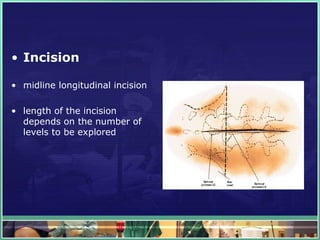 Longitudinal Incsion Lumbar spinal stenosis, laminectomy, prolapsed intervertebral disc | PPTX