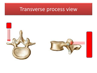 Transverse Process Process Lumbar spine sonoanatomy | PPTX