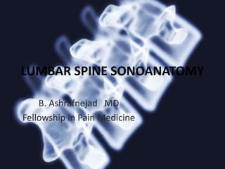 LUMBAR SPINE SONOANATOMY
B. Ashrafnejad MD
Fellowship in Pain Medicine
 