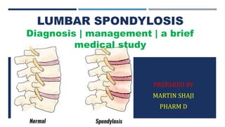 PREPARED BY
MARTIN SHAJI
PHARM D
LUMBAR SPONDYLOSIS
Diagnosis | management | a brief
medical study
 