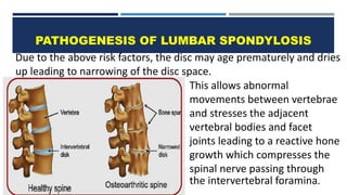 Lp Risks Nerve Lumbar spondylosis- Diagnosis | management | a brief medical study | PPTX