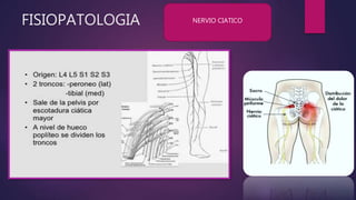 FISIOPATOLOGIA NERVIO CIATICO
 