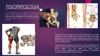 FISIOPATOLOGIA
El nervio ciático inerva la pierna a nivel sensitivo y motor. Es
decir, a través del nervio ciático pasan las fibras que reciben
estímulos de la sensibilidad de la piel de la pierna y pasan fibras
que transmiten estímulos a los músculos para que éstos se
muevan.
Cuando el dolor se origina en la raíz de la vértebraL4- L5, el dolor
empieza en el gluteo pasa por la parte posterior del muslo, luego
desciende sobre su parte lateral, atraviesa la rodilla en posición
lateral y llega a la pierna, luego a nivel del maleolo externo y acaba
a vec en el dedo hallux
Cuando el dolor se origina en la raíz S1, suele extenderse por el
glúteo, la parte posterior del muslo, la rodilla, la pierna, el talón y el
borde externo del pie hasta el quinto dedo.
En otros casos, dependiendo de los síntomas, se recomienda
operar para descomprimir la raíz nerviosa.
 
