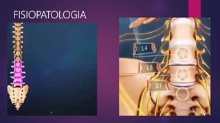 FISIOPATOLOGIA
 