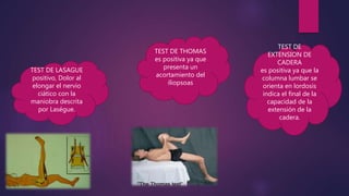 TEST DE THOMAS
es positiva ya que
presenta un
acortamiento del
iliopsoas
TEST DE
EXTENSION DE
CADERA
es positiva ya que la
columna lumbar se
orienta en lordosis
indica el final de la
capacidad de la
extensión de la
cadera.
TEST DE LASAGUE
positivo, Dolor al
elongar el nervio
ciático con la
maniobra descrita
por Laségue.
 