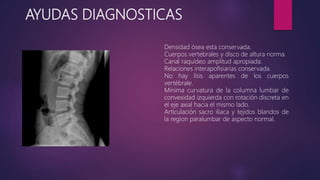 AYUDAS DIAGNOSTICAS
Densidad ósea esta conservada.
Cuerpos vertebrales y disco de altura norma.
Canal raquídeo amplitud apropiada.
Relaciones interapofisiarias conservada.
No hay lisis aparentes de los cuerpos
vertébrale.
Mínima curvatura de la columna lumbar de
convexidad izquierda con rotación discreta en
el eje axial hacia el mismo lado.
Articulación sacro iliaca y tejidos blandos de
la region paralumbar de aspecto normal.
 