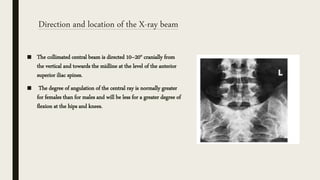 Lumbo sacral,coccyx sacrum anatomy and positioning | PPTX