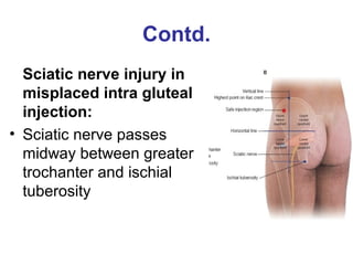 Lumbosacral plexus by dr swapan (1) | PPT