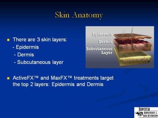 Lumenis Powerpoint Presentation | PPT