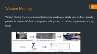 Western blotting
Western blotting (or protein immunoblotting) is a technique widely used to detect specific
proteins in samples of tissue homogenate, cell lysates, cell culture supernatants or body
fluids.
32
 
