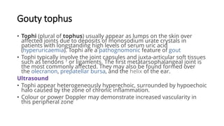 LUMPS AND BUMPS . clinical and ultrasound | PDF