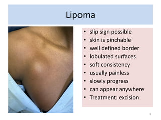 Slipped Sign Management of common Lumps and Bumps PPH 2025.pdf