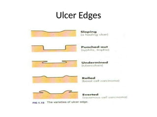 Comprehensive Surgical Examination of Lumps and Ulcers: Diagnosis and ...