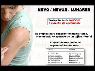 Deriva del latín NAEVUS
= mancha de nacimiento
Se emplea para describir un hamartoma,
crecimiento exagerado de un tejido normal
El apellido nos indica el
origen celular del nevo…
 