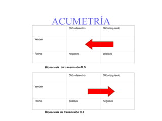 ACUMETRÍAOído derecho Oído izquierdo
Weber
Rinne negativo positivo
Hipoacusia de transmisión O.D.
Oído derecho Oído izquierdo
Weber
Rinne positivo negativo
Hipoacusia de transmisión O.I
 