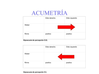 ACUMETRÍA
Oído derecho Oído izquierdo
Weber
Rinne positivo positivo
Hipoacusia de percepción O.D.
Oído derecho Oído izquierdo
Weber
Rinne positivo positivo
Hipoacusia de percepción O.I.
 