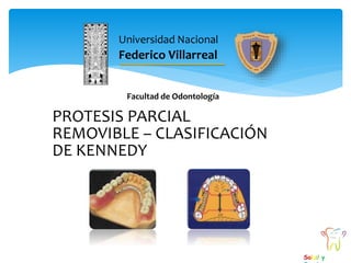 Universidad Nacional
Federico Villarreal
Facultad de Odontología
Salud y
PROTESIS PARCIAL
REMOVIBLE – CLASIFICACIÓN
DE KENNEDY
 