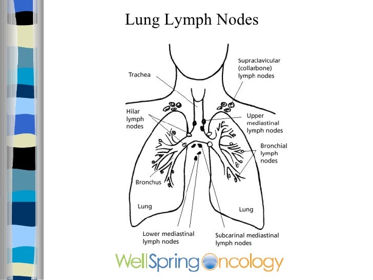 Lung Cancer