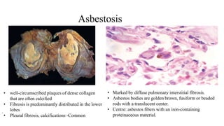 Fuiform Rods lung- Gross &Microscopy | PPTX
