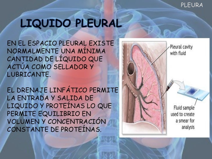 Pleura & Pulmones