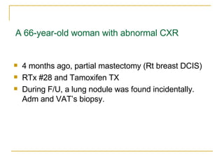 A 66-year-old woman with abnormal CXR ,[object Object],[object Object],[object Object]