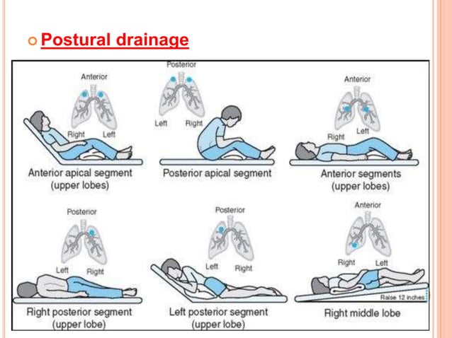 Lung abscess & Nursing care | PPTX