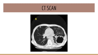 CT SCAN
 