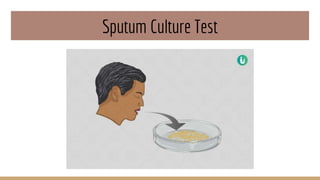 Sputum Culture Test
 