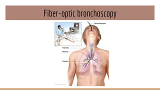 Fiber-optic bronchoscopy
 
