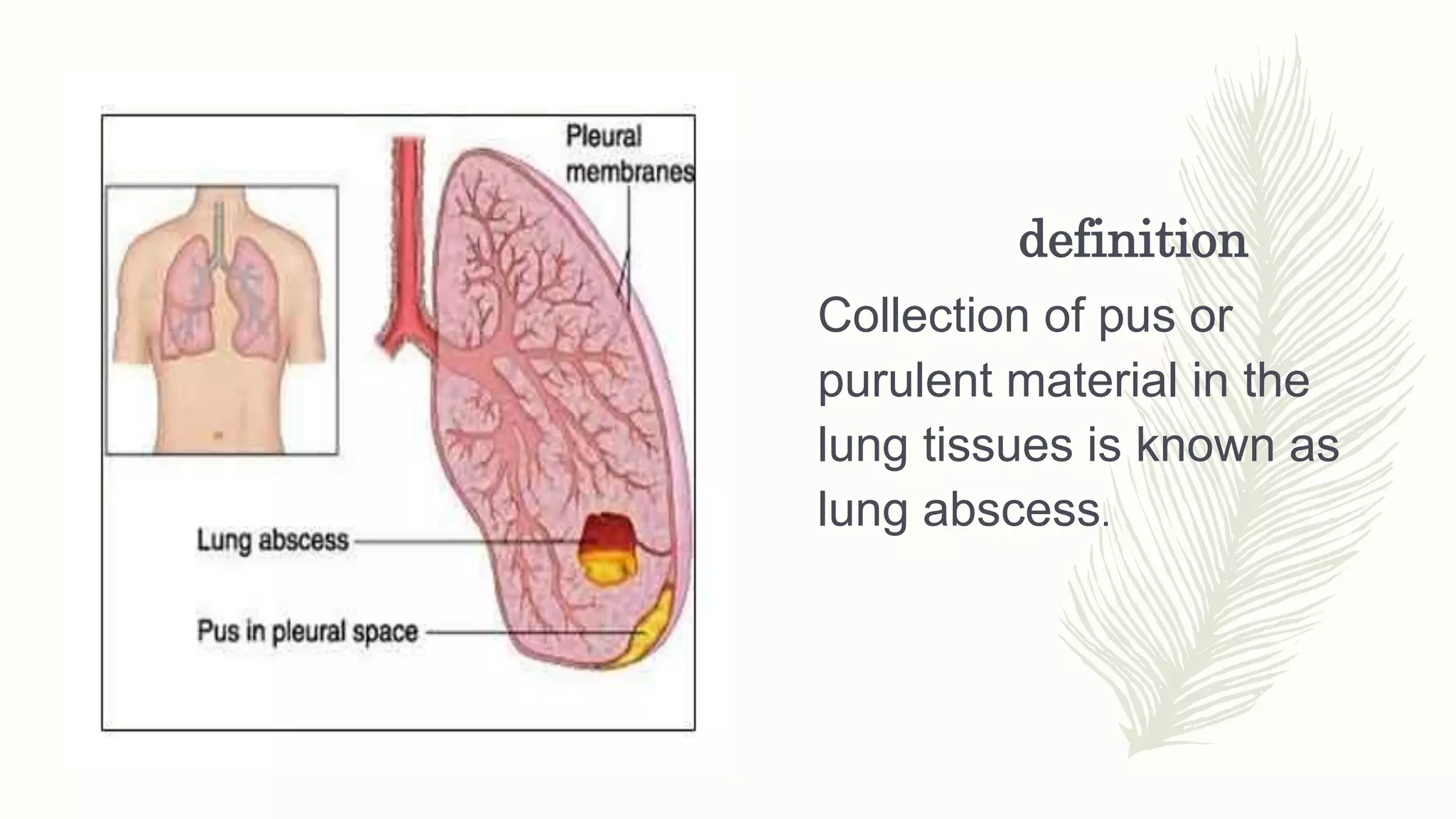 Lung abscess.pptx