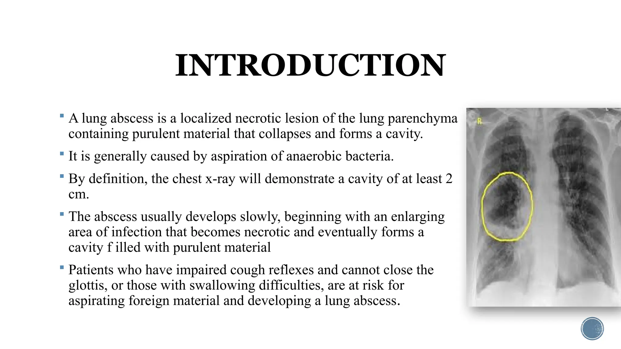 The LUNG ABSCESS by Anushri Srivastava.pptx
